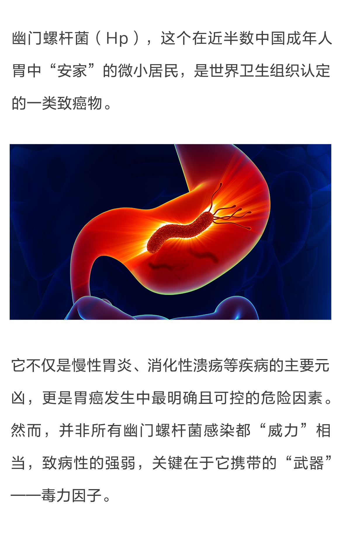 幽门分型上市_01.png